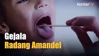 Gejala Umum Radang Amandel Pada Anak