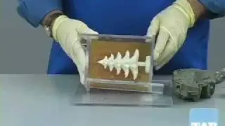 How to make a two-part mold