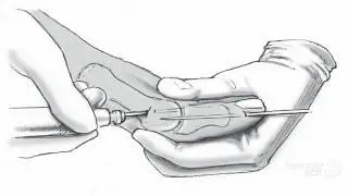 шишка на пальце ноги болит

  - Valgus Pro оригинал