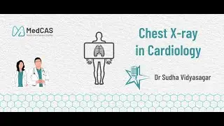 Chest X Ray By Professor Sudha Vidyasagar