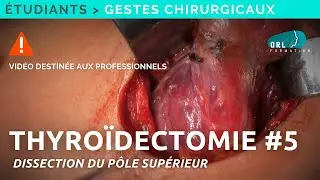 Comment réaliser une thyroïdectomie | #5 Dissection du pôle supérieur | Formation chirurgie ORL