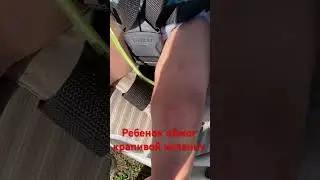 Ребенок обжегся крапивой#shorts