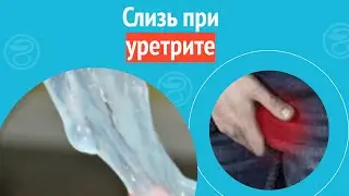 😐 Слизь при уретрите. Клинический случай №1458