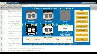 Lung Cancer Detection Using Neural Network Matlab Project With Source Code Detection Of Lung Cancer
