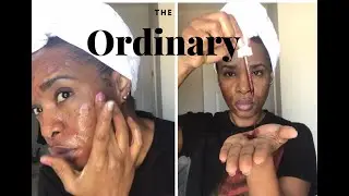 THE ORDINARY CHEMICAL PEEL FULL PROCESS-HOW TO USE