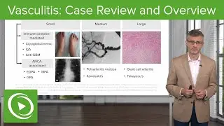 Vasculitis: Case Review and Overview | Lecturio