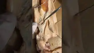 Squid Dissection 6: Female Reproductive and Excretory Systems