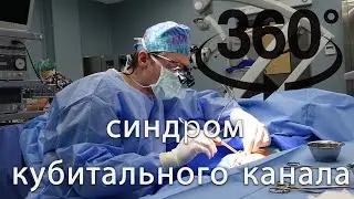 Видео 360! Как др. Микиянскис проводит операцию синдрома кубитального канала?