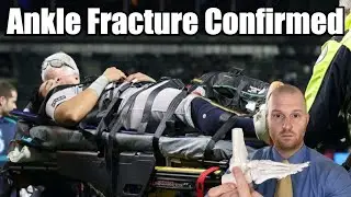 Oswaldo Cabrera Injury Update!  Oswaldo Cabrera Ankle Injury