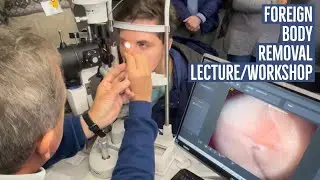 Optometry: Foreign Body Removal Workshop & Therapeutics Session with Dr. Dirk Booysen