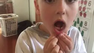 Jacobs first lost tooth. HD
