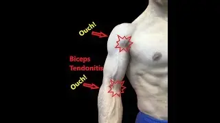 Biceps Tendonitis | Exercises And Myofascial Release