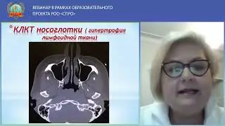 КЛКТ И СОВРЕМЕННЫЕ МЕТОДЫ ЛД  ВНЧ СУСТАВА, ЗУБОЧЕЛЮСТНОЙ СИСТЕМЫ И ЧЛО