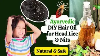 Lice-Free Hair Naturally | DIY Ayurvedic Homemade Hair OIL for Stubborn Lice & Nits!