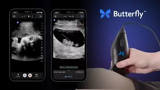 Butterfly It: OB/GYN Ultrasound