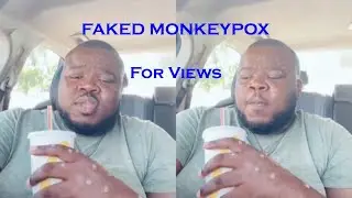 Man Fakes Monkey Pox For Views
