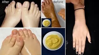 सालों साल जमी मैल व गंदगी शरीर से मिनटों में साफ करें| Remove, Dirt, Dead Skin Cells In just 1 Time