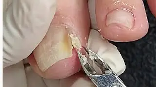 Deep cuticle removal - look what came out of this corner, I'm shocked 😱