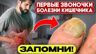 6 симптомов Грязного Кишечника! Как проверить кишечник за 4 мин.