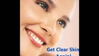 Revitol Scar Cream Review