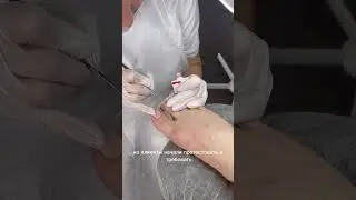 Now my sister does a pedicure🫣 