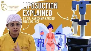 What is Liposuction || Dr. Karishma Kagodu || Dr. Karishma Aesthetics, Bengaluru, India.