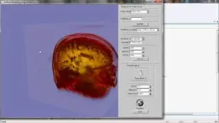 Volume RayCasting of Human Brain dataset