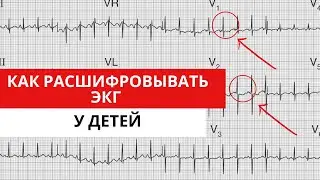 ECG in Children. Features of ECG analysis. Differences from an adult ECG.