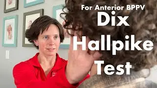 Dix Hallpike Diagnostic Test for Anterior BPPV