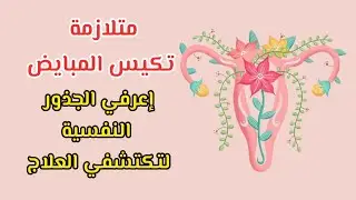 تعرفي على الجذور النفسية لمتلازمة تكيس المبايض و اكتشفي العلاج... إذا عُرِف السبب بَطُل العجب ✨