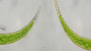 Closterium - Dance of the Gypsum Crytals