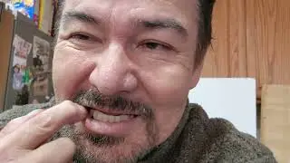 Mi experiencia con implantes dentales totales.