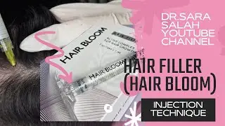 Hair filler injection technique (hair bloom)