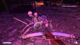 Bedlam - Skeletons going wild