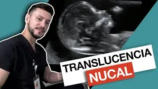 ¿Qué es la TRANSLUCENCIA NUCAL?