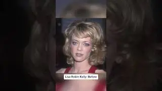 Celebrities before and after drug 