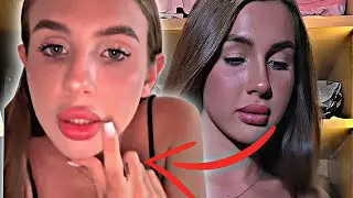 Леди Диана пожалела, что увеличила губы | Lady Diana Stories