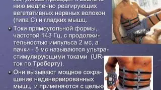 Электростимуляция 1