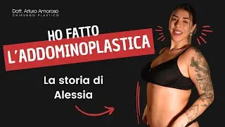 Addominoplastica: La Storia di Alessia  - Dott. Arturo Amoroso
