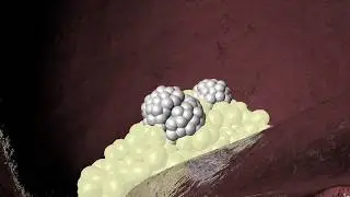 Niacin for high Cholesterol levels