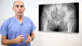 Pubalgia del futbolista