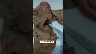 El cuello del útero o cervix uterino