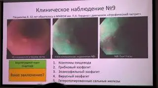 31OLYMPUS 3 Пирогов СС Щербаков ПЛ Эндоскопическая Викторина Пищевод Клинические Загадки