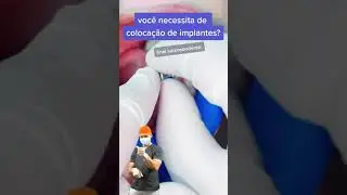 IMPLANTE DENTÁRIO, VOCÊ PRECISA?