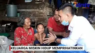 Derita Seorang Warga Yang Tinggal di Gubuk, Butuh Perhatian Khusus Dari Pemerintah Pemerhati Sosial