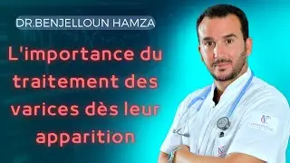 L'importance de Traiter les Varices dès leur Apparition