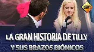 Tilly Lockey y sus brazos biónicos - El Hormiguero
