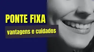 Cuidados com a ponte fixa adesiva  recomendações