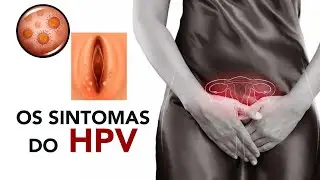 Os sintomas do HPV