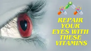 8 Most POWERFUL Vitamins To REPAIR & Heal Your EYES